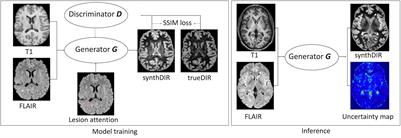 Uncertainty-Aware and Lesion-Specific Image Synthesis in Multiple Sclerosis Magnetic Resonance Imaging: A Multicentric Validation Study